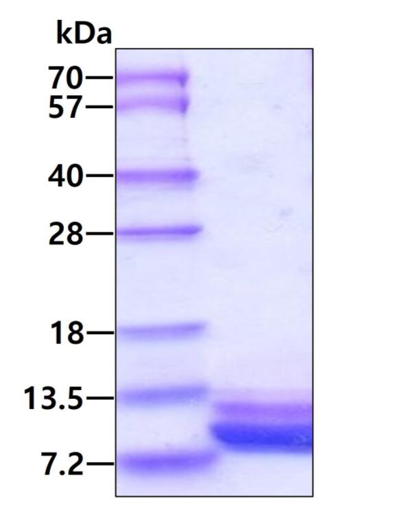 3 μg by SDS-PAGE under reducing condition and visualized by coomassie blue stain.